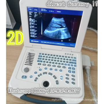 cheap price black and white ultrasound machine portable